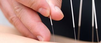 needles in the body
